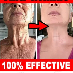 No wrinkles, 20 years younger